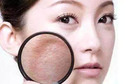 毛孔收缩精华和毛孔收敛水,毛孔粗大收缩毛孔最有效的项目