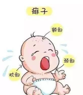 长痱子怎么办婴幼儿,长痱子怎么办