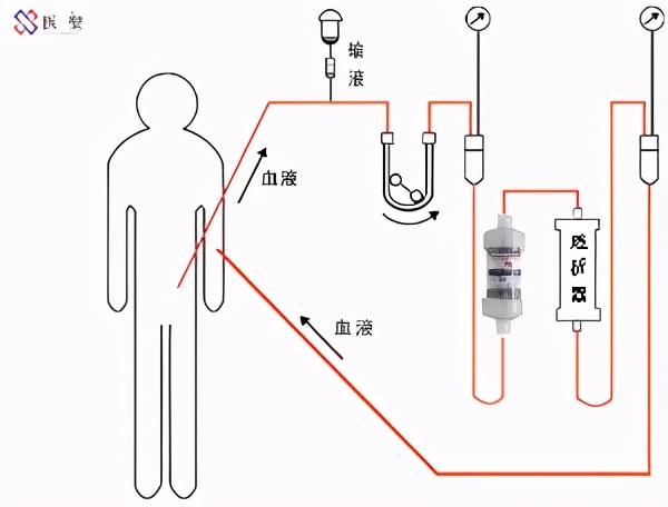 干细胞可以治疗肾功能,干细胞再生治疗肾衰竭