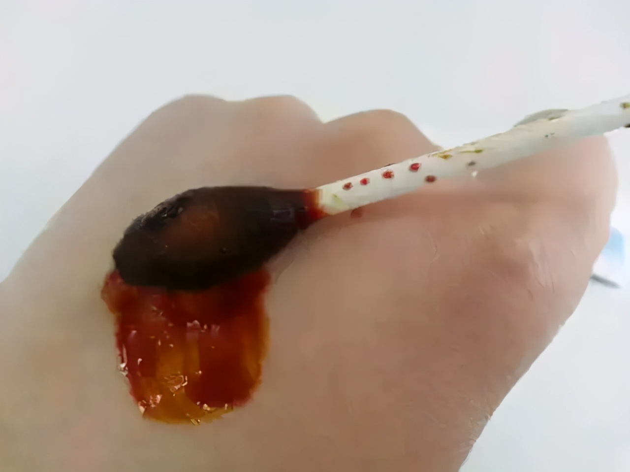 碘酊和碘伏的区别和注意事项，村医别搞错了​