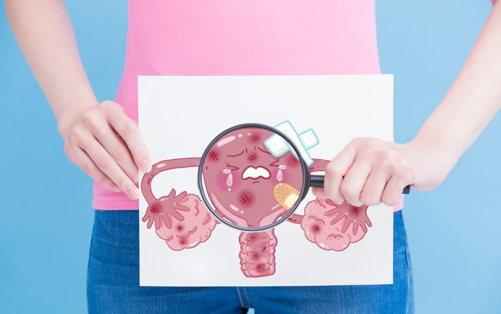 不疼不痒查出卵巢癌，很难理解？其实你身体早已发出了3个信号