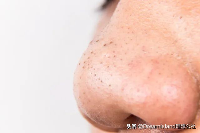 夏日指南送你一份好物清单,夏日必备好物备上它想不美都难