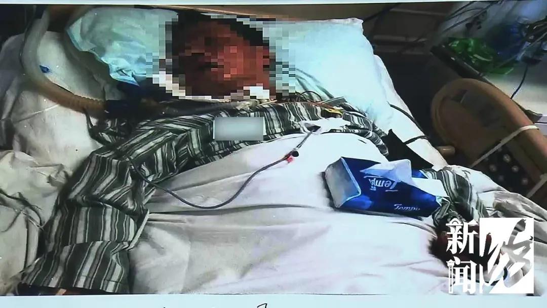 男子吃了这种鱼后中毒,不小心吃了剧毒章鱼的人