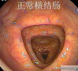 结肠镜检查，痛苦并快乐着