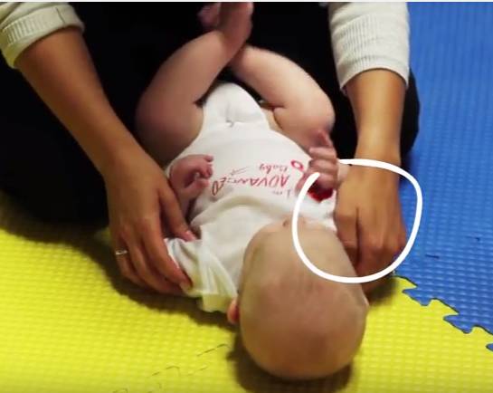 二十天的新生儿斜颈一天按摩几次,宝宝头总是往一边扭头是斜颈吗