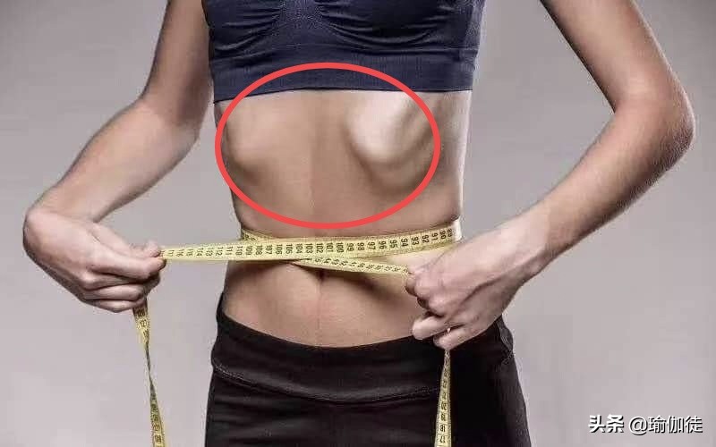 肋骨外翻矫正后还会外翻吗,一边肋骨外翻一边不外翻