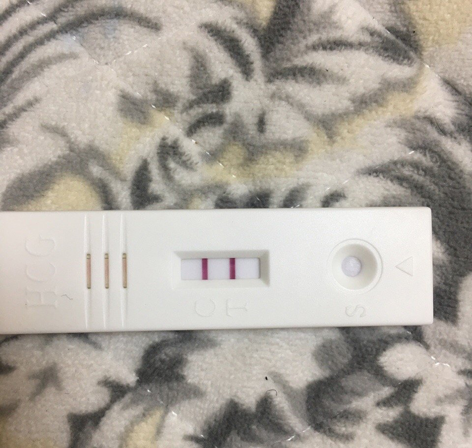 孕妈咪必须了解的自然分娩技巧,头胎孕妇顺产经历