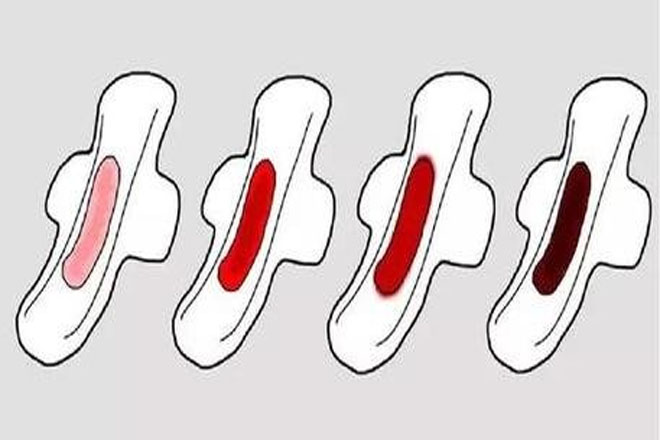 月经伴有这三种情况一定要看医生,月经颜色可以看出妇科病