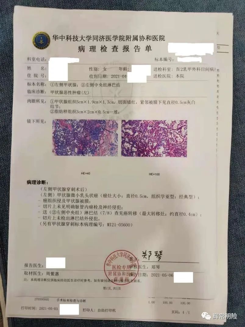 理赔实录|甲状腺癌赔50.91万，免除保险费25.5万，保障继续有效