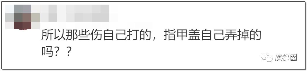 短跑名将张培萌家暴事件,短跑名将张培萌被控家暴