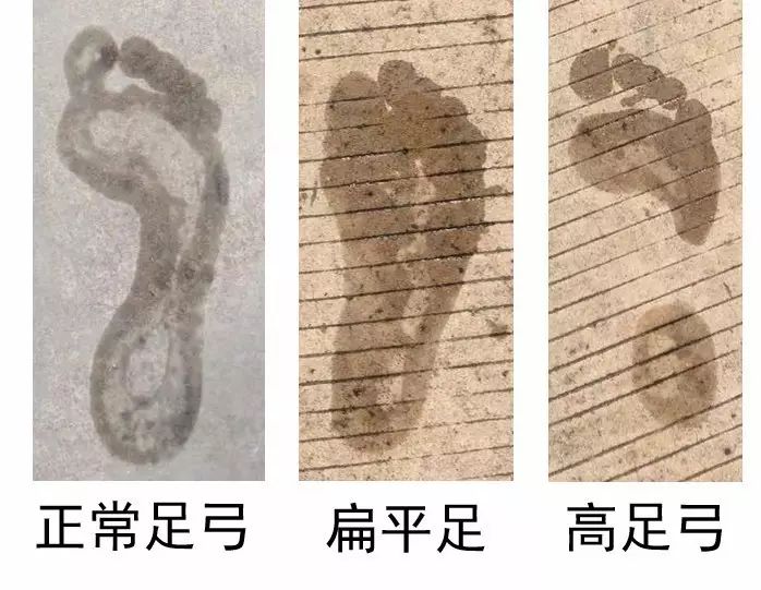 初级跑者如何选鞋,跑者测评都穿什么鞋