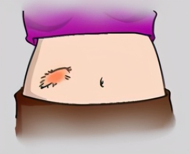 为什么先注射胰岛素再注射葡萄糖,胰岛素注射笔使用方法及注射部位