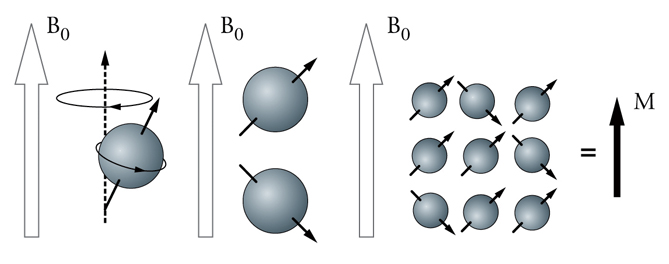 磁共振怎么看大脑基底节区和丘脑,脑核磁能不能看清楚骨头