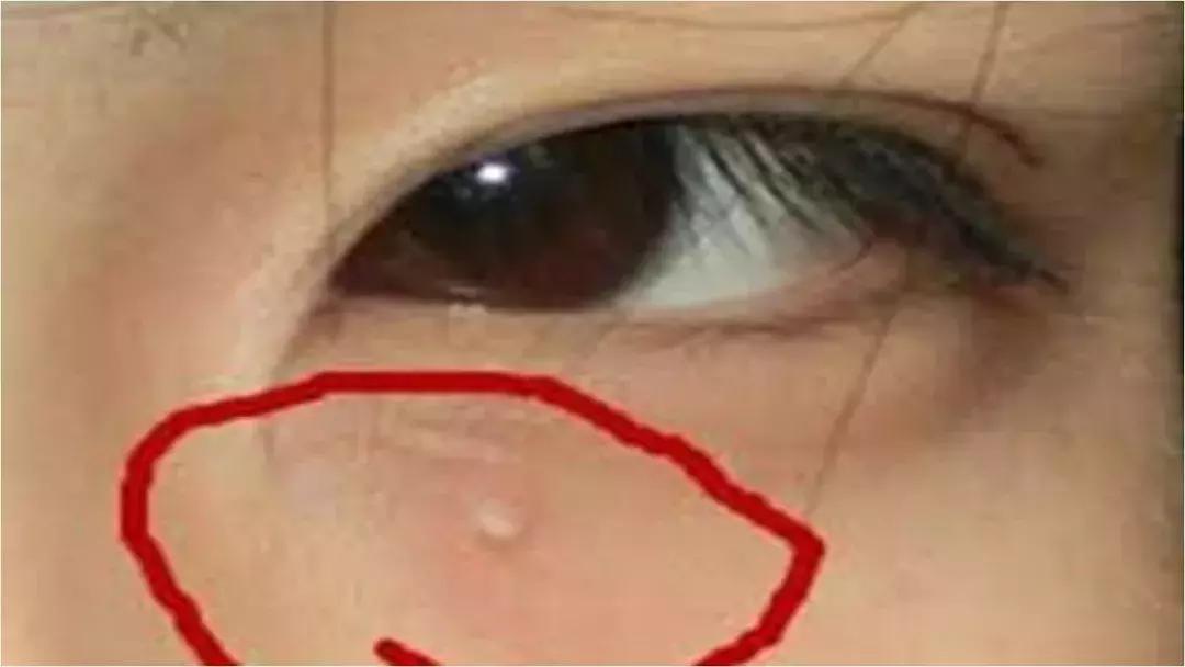 30-40岁最适合的中国眼霜,40岁以后用哪一款眼霜