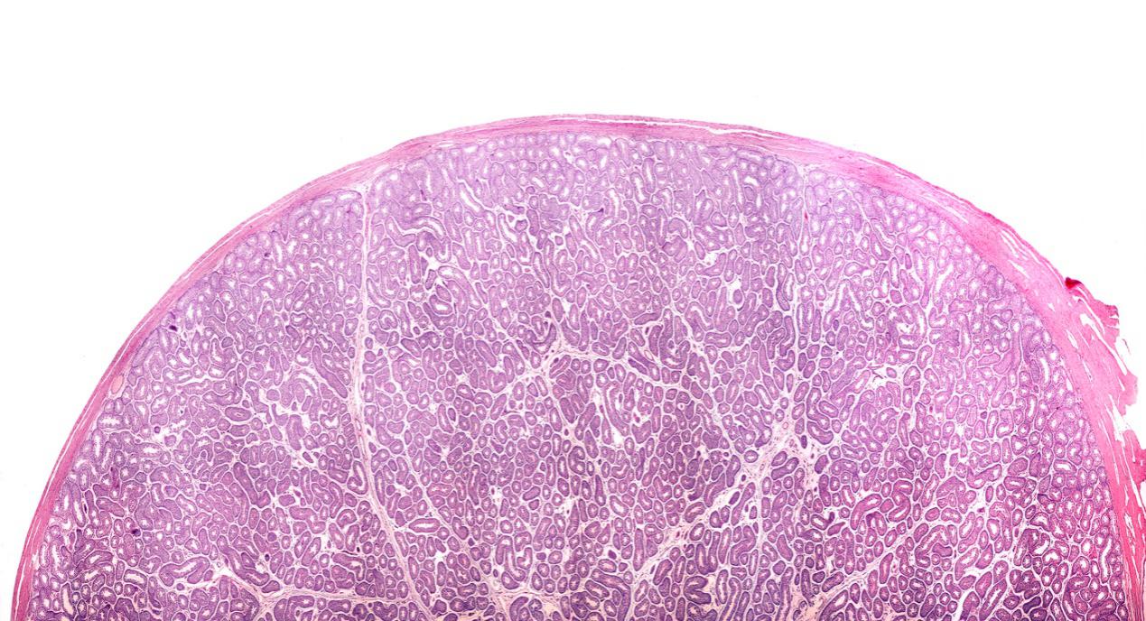 害怕蛋蛋坏掉生不了娃，男性新福利“可拆卸蛋蛋”了解一下？