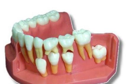 为什么孩子掉牙后没长出来,为什么孩子6岁就掉牙了