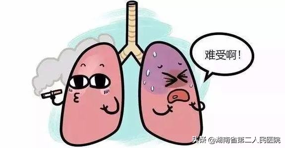 30年老烟民得肺癌的几率高吗,30岁肺癌三处疼痛