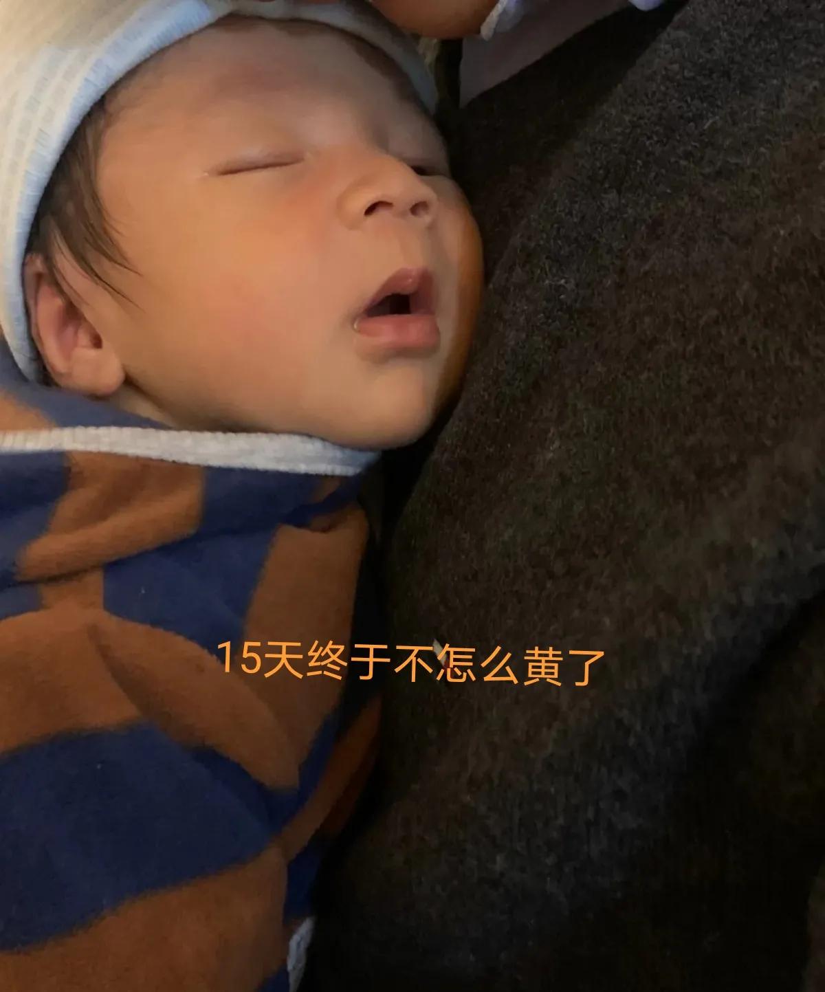 宝宝黄疸好转有哪些征兆,亲身经历宝宝黄疸过程