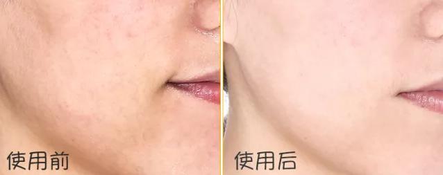 敏感肌换季好物,敏感肌水乳抗皱天花板