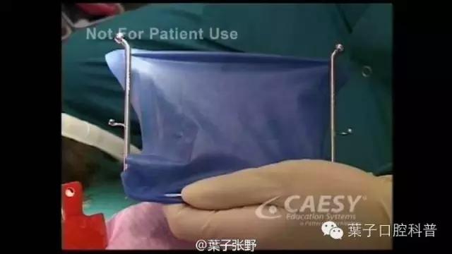 牙龈反复鼓包流脓是牙齿坏了吗,一上火牙龈就鼓包