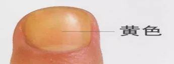 指甲有四种现象很危险,指甲反映身体状况