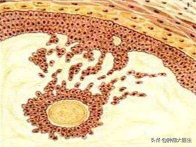 不查不知道一查吓一跳的肿瘤标志物到底预示什么病？