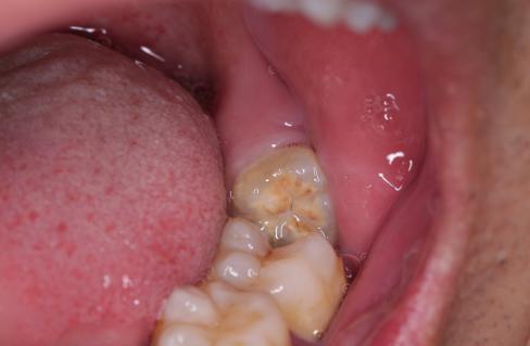 美国警察跪杀案宣判,美国警察跪杀案例