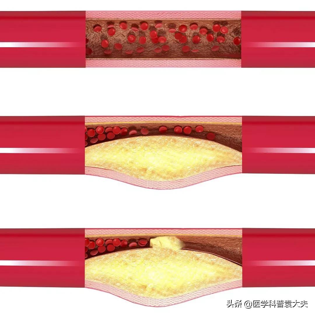 心血管健康您应知道的,心脑血管预防知识图