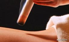 艾灸专家讲艾灸疗效,在家艾灸哪种灸法效果最好