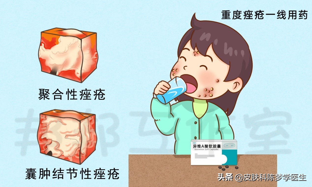 脸上青春痘用什么护肤品,青春痘抗组胺药物有哪些