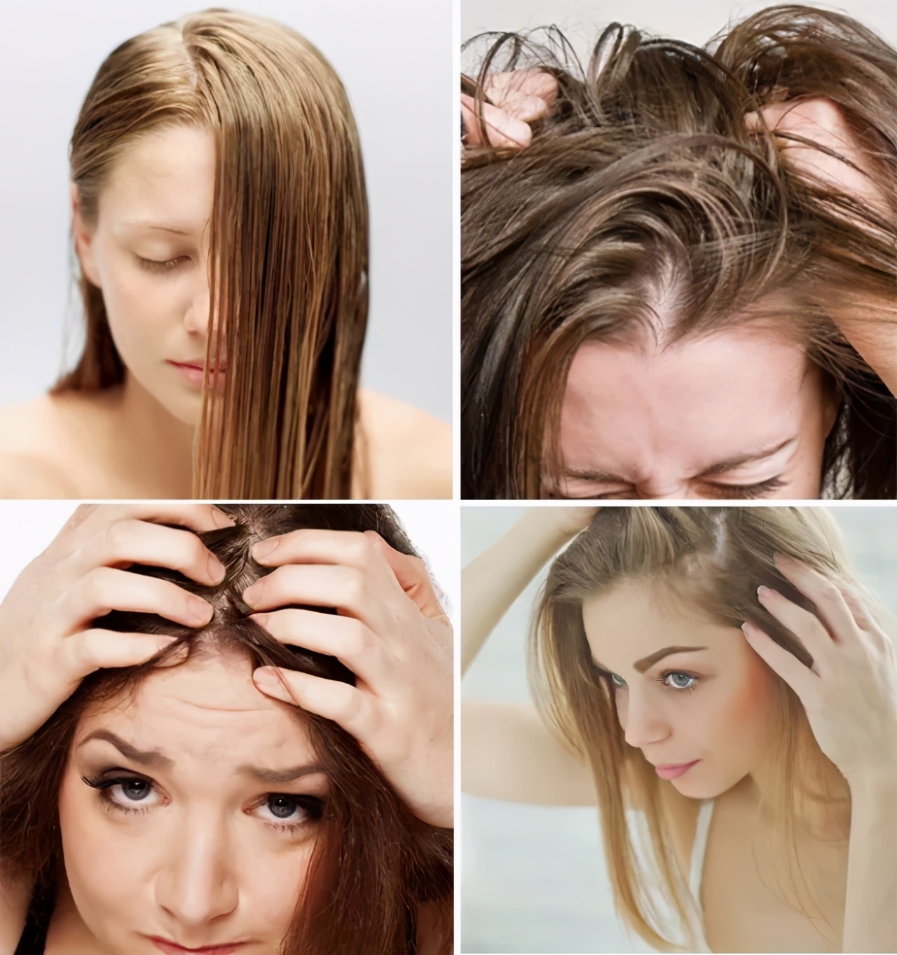 头发爱出油用什么可以变蓬松,头发油怎么才能头发蓬松干爽