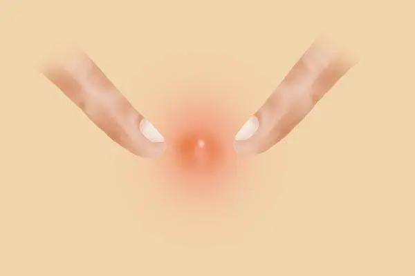 下巴颏摸着有个疙瘩是怎么回事,下巴上密密麻麻的小疙瘩是什么