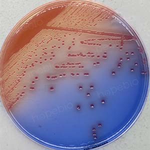 大肠埃希菌培养,大肠埃希菌70%正常吗