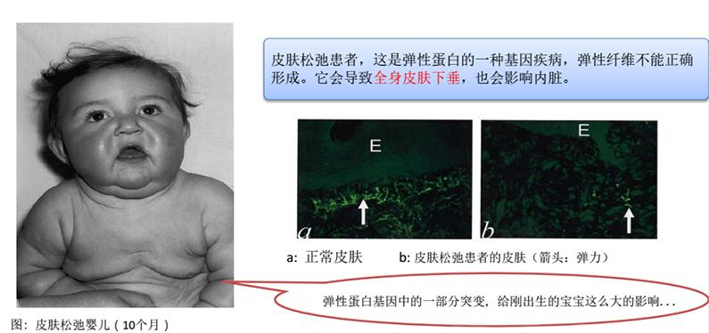 弹性蛋白哪里的最好,关于胶原蛋白肽的知识