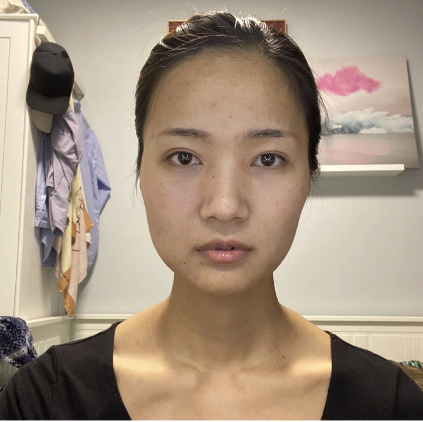 大小脸影响大吗,大小脸能不能改善