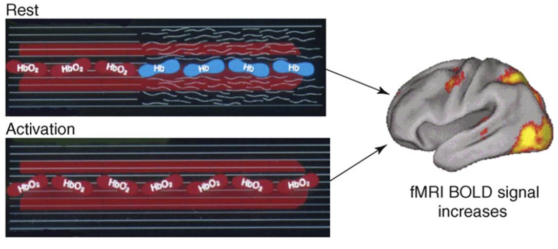 脑功能成像和血管成像,核磁共振脑成像mra是查什么的