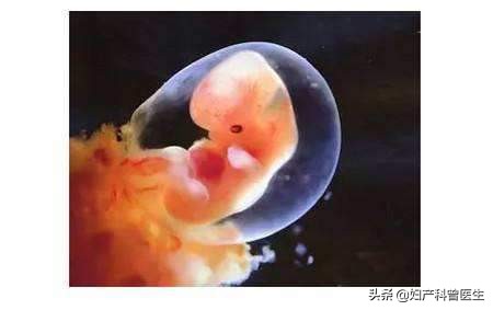 自然流产的如果保胎能保住吗,自然流产后再次怀孕需要保胎药吗