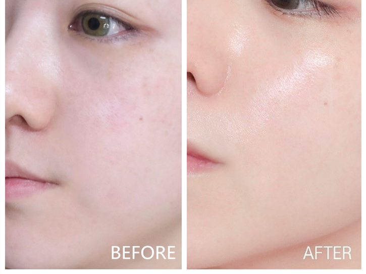 苏秘鎏金水乳适合什么肤质,苏秘鎏金水乳好用吗