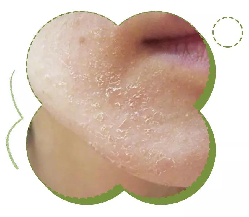 「推荐」19.9元/2罐绵羊油，全身可用，嫩回少女肌