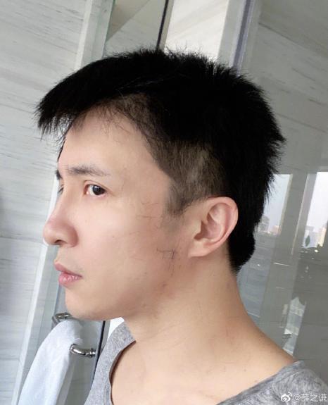薛之谦推鬓角,薛之谦发型剃坏