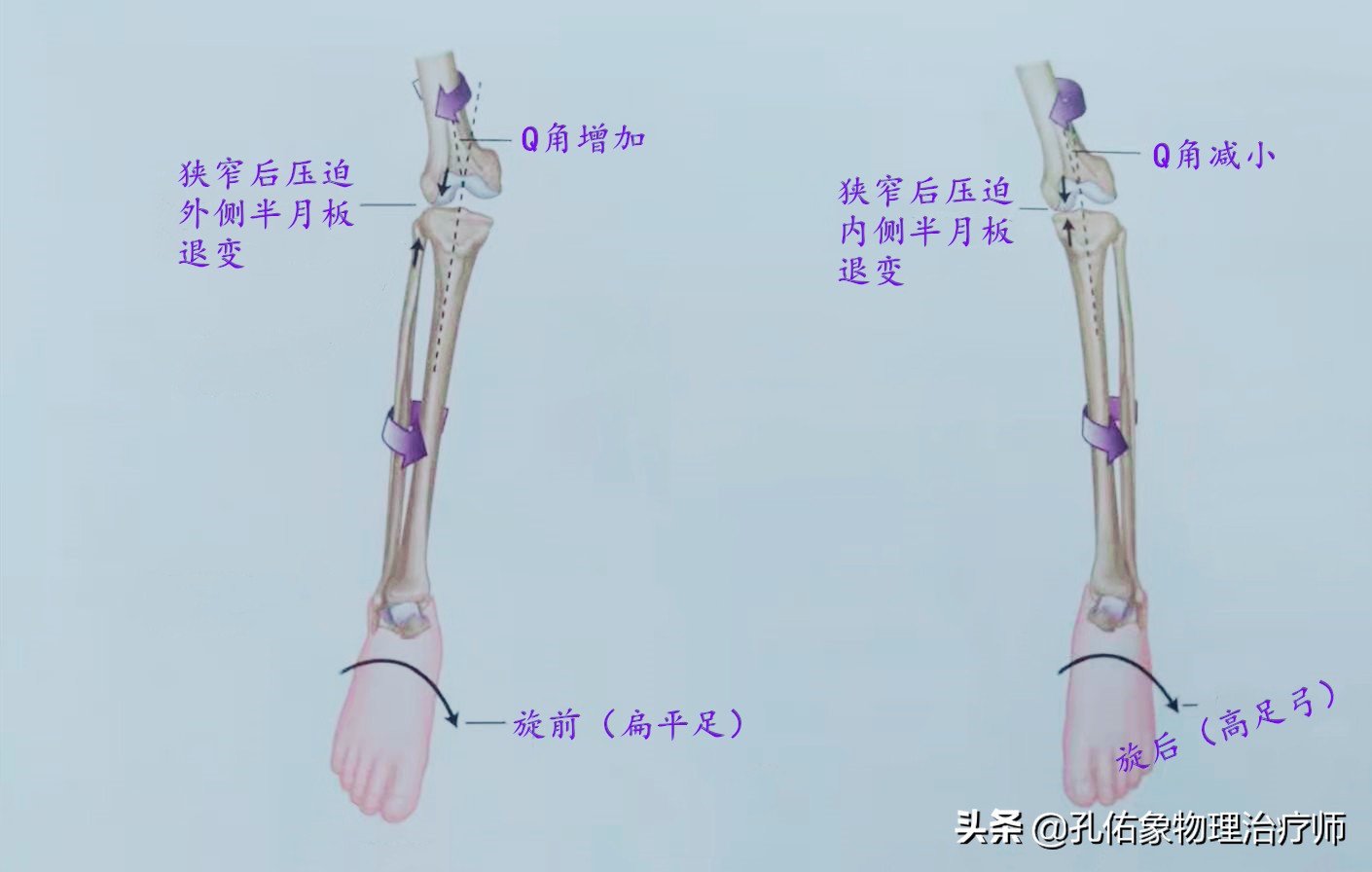 久坐右边臀部疼痛发麻怎么锻炼,久坐臀部疼痛怎么锻炼