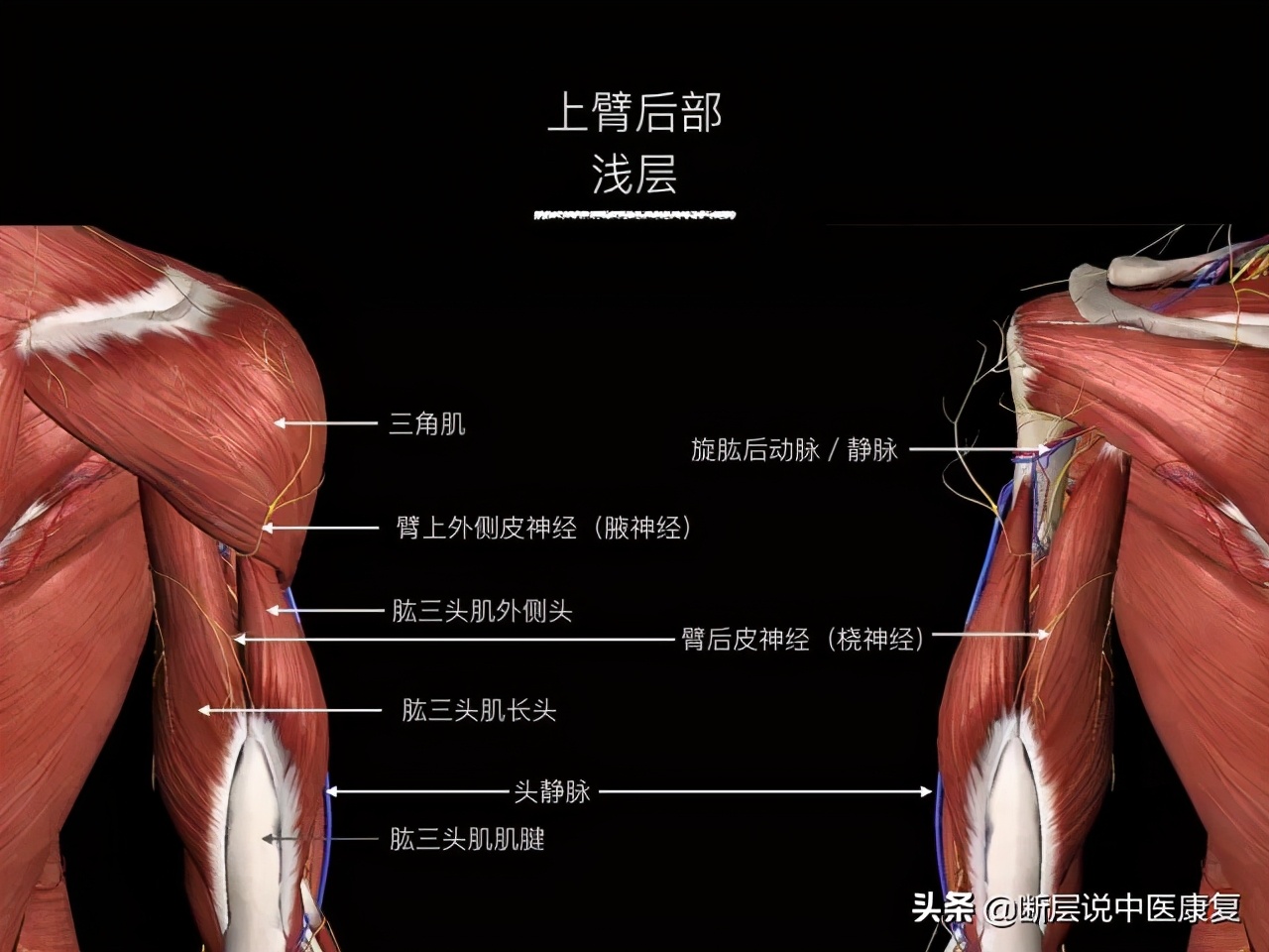 手臂人体解剖图讲解,手臂上举3d肌肉解剖讲解