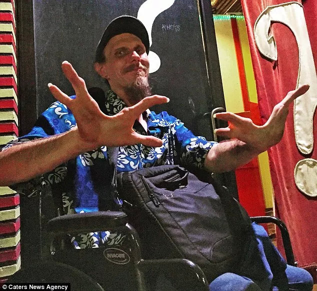 家暴谋杀却逍遥法外，先天畸形反而助长“龙虾男孩”的邪恶