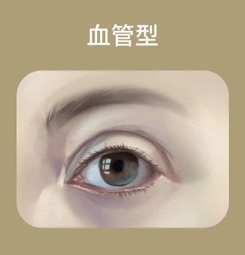 有严重的黑眼圈怎么才能好,黑眼圈最近越来越严重怎么解决