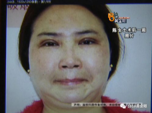 感觉自己不如以前漂亮了,感觉自己不如以前好看