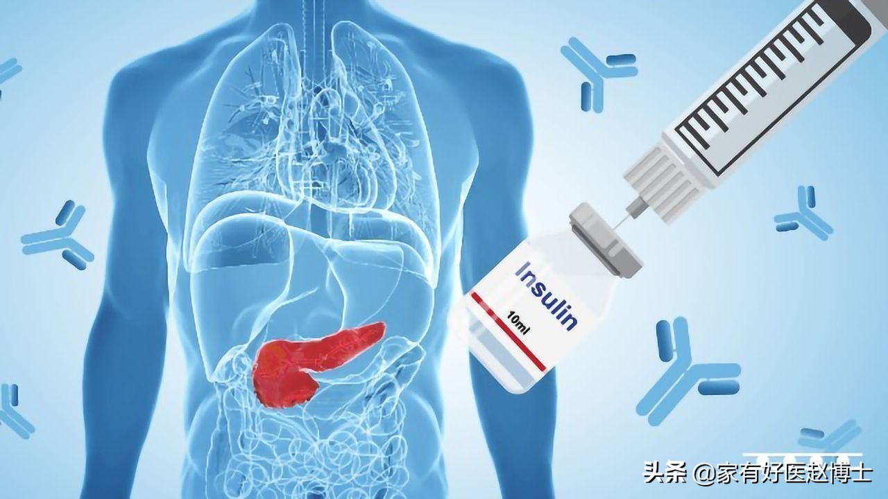 血糖高怀疑是糖尿病早期,怀疑血糖高一般有什么预兆