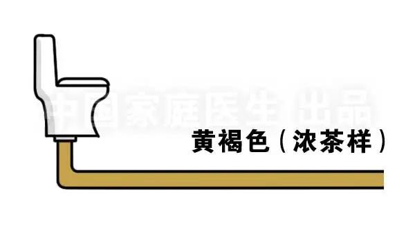 上厕所有四个症状说明肝有问题,上厕所时肾有刺痛是怎么回事