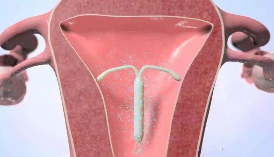 20岁女孩第四次人流,二十一岁女孩人流五次