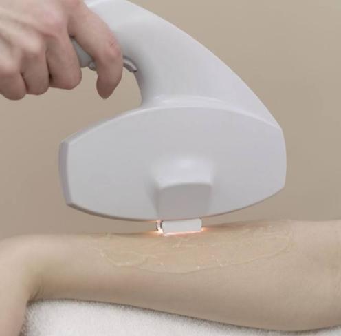 成都美容脱毛,成都美容激光脱毛