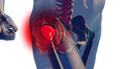 新冠用激素会造成股骨头坏死吗,新冠激素治疗的后遗症